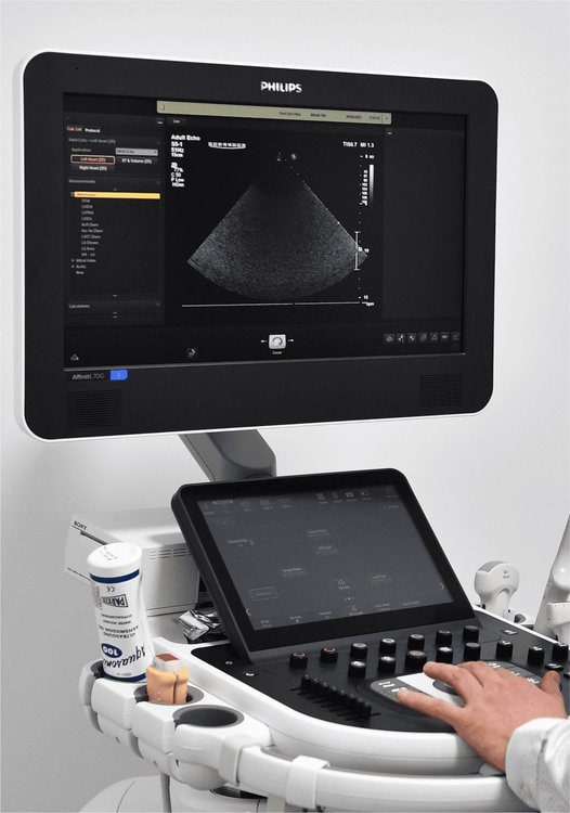 Ecograf 4D la Clinica Medical One